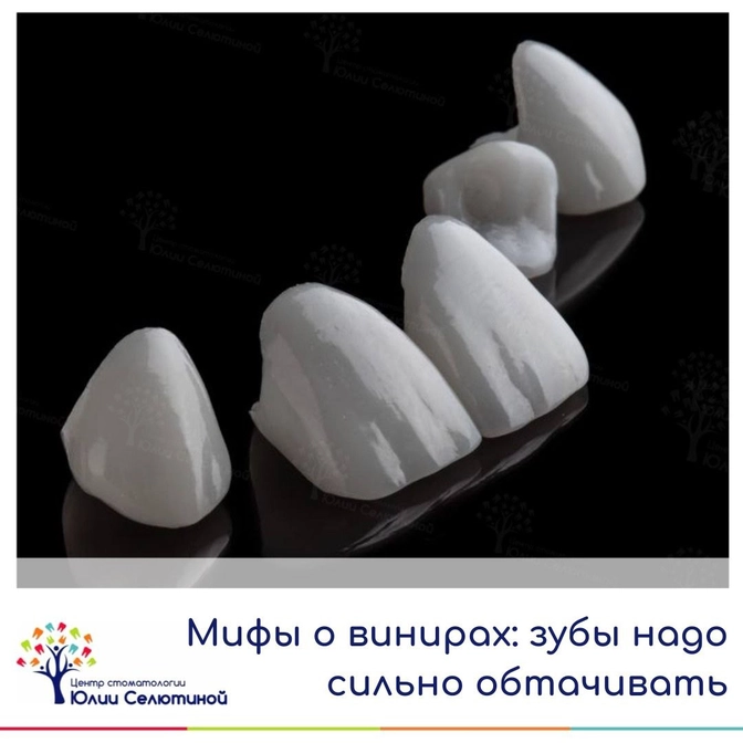 Мифы о винирах: зубы нужно сильно обтачивать