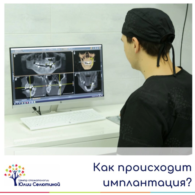Как происходит имплантация?