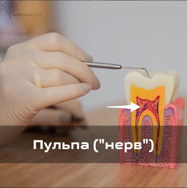 Пульпа (нерв)