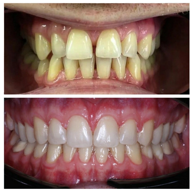 Тотальная реабилитация пациента длиною в 3 года