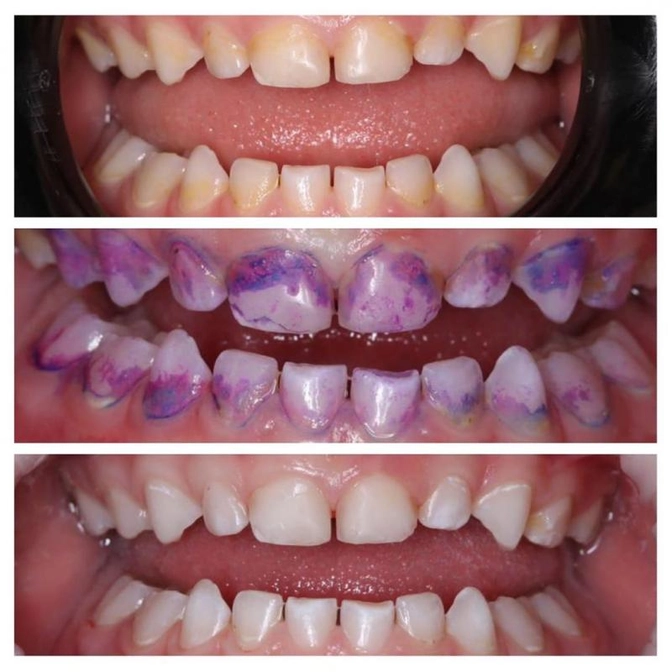 Последствия несоблюдения рекомендаций