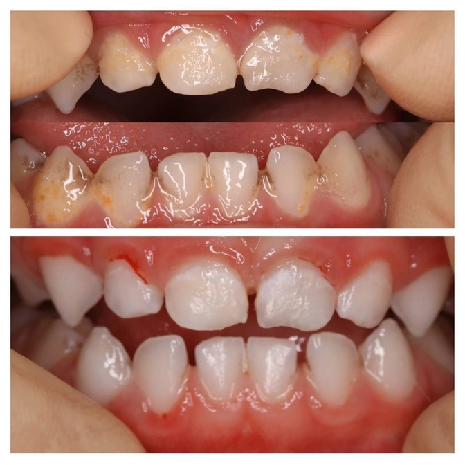 Когда можно без наркоза? 