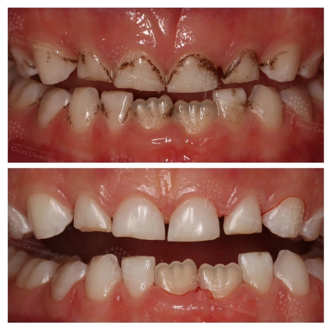 Всё о налёте Пристли 