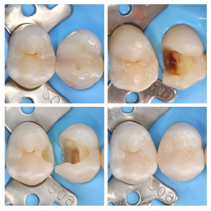 Почему нужно регулярно посещать стоматолога? 