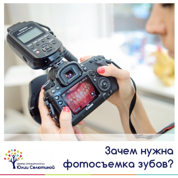 Зачем нужна фотосъемка зубов? 