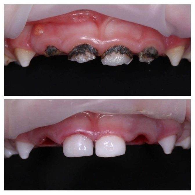 Почему я против серебрения? 