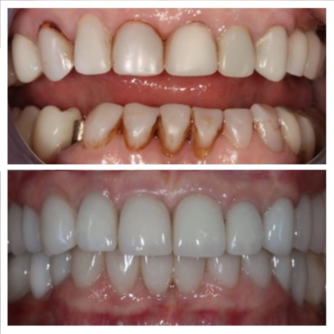 Когда нужен гнатолог 