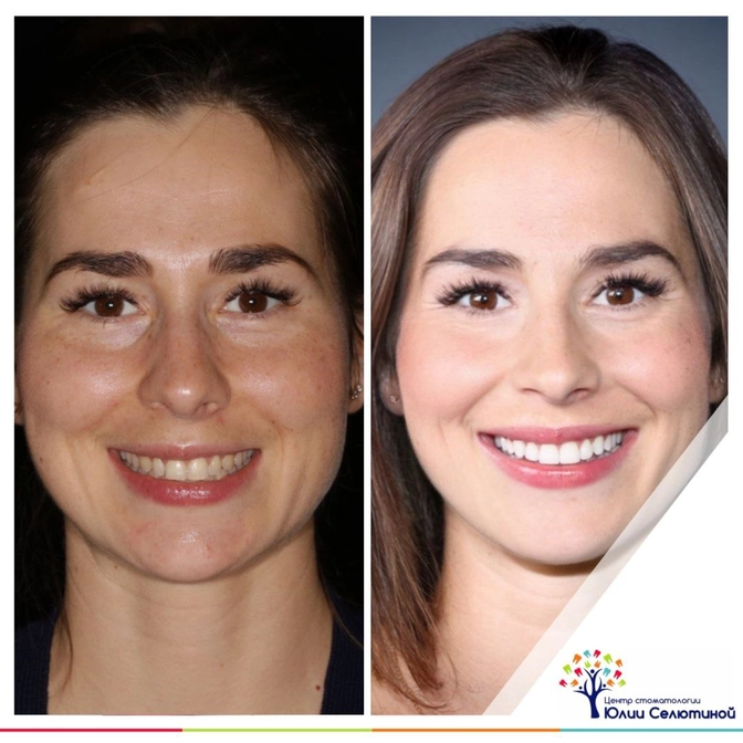 Комплексный подход к восстановлению эстетики 