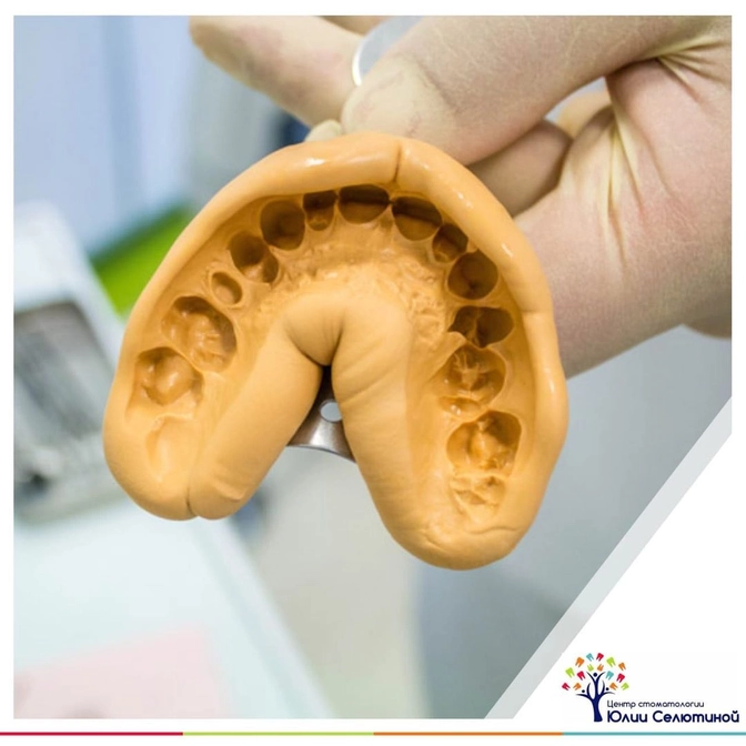 Как делаются слепки в стоматологии? 