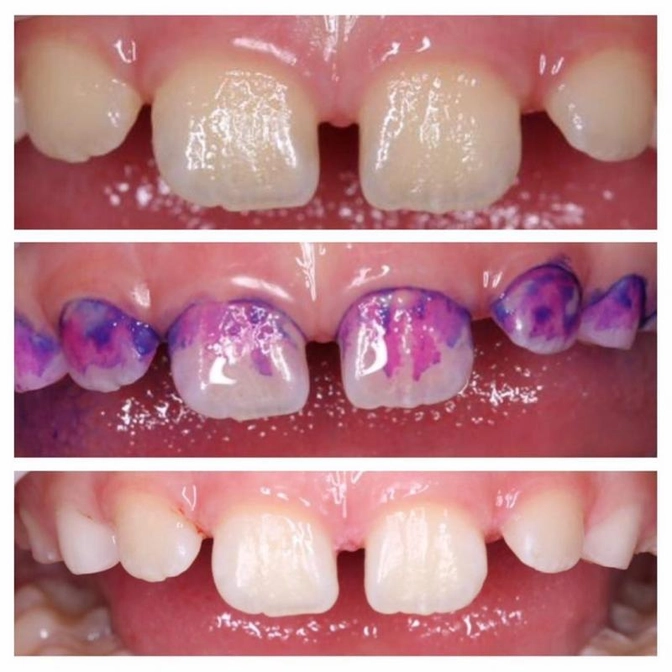 Индикаторы налёта: в чем их преимущества и как ими пользоваться?