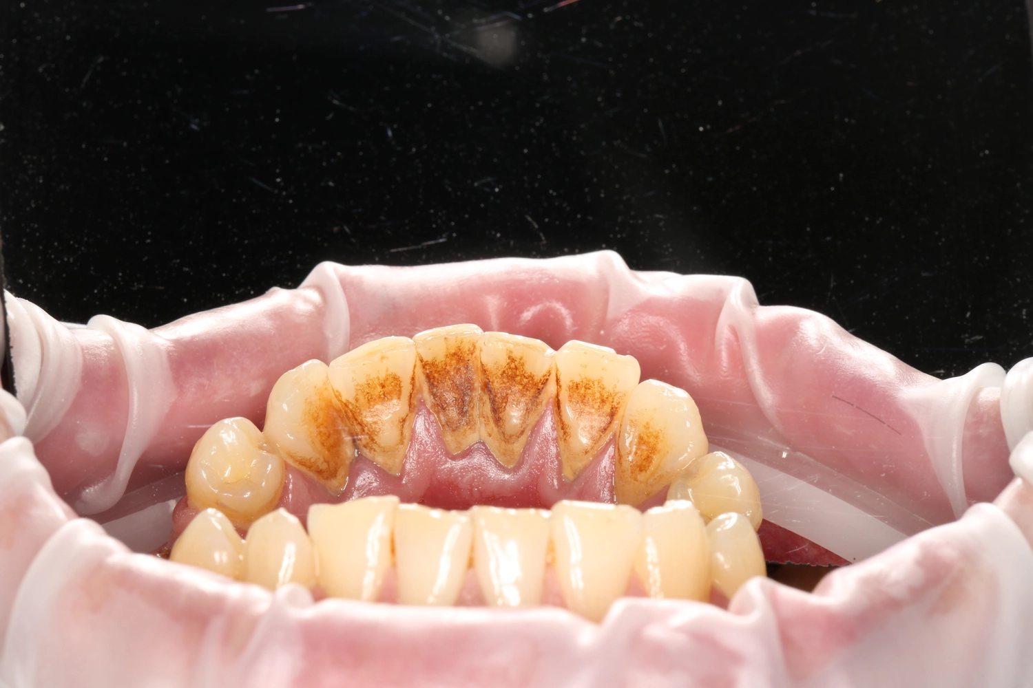 Изображение зубов до прихода в клинику