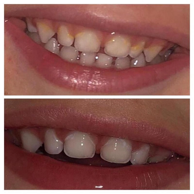 Лечение с удержанием: можно ли?