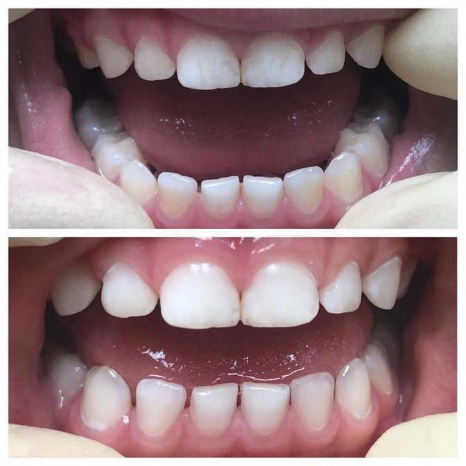 К стоматологу после каникул