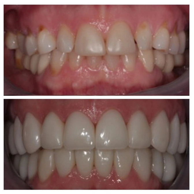 Когда нужен гнатолог?