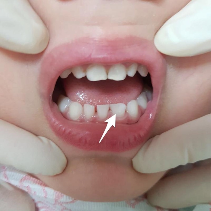 Клинический случай.