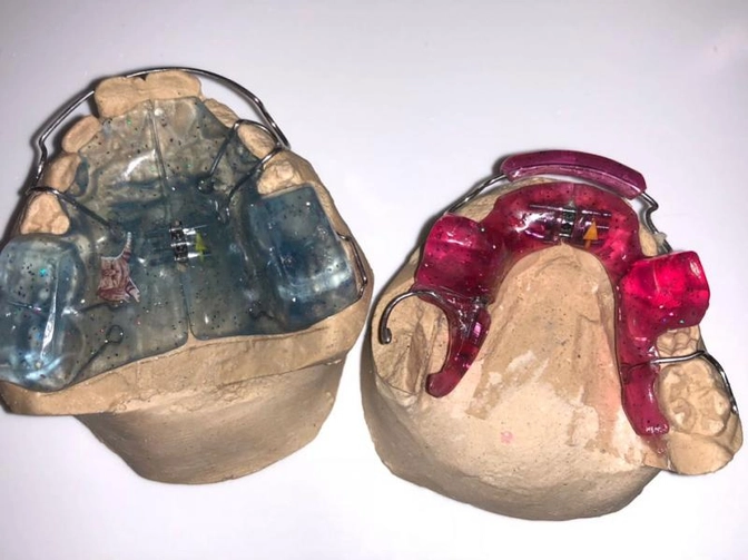 Аппарат Твин-Блок.