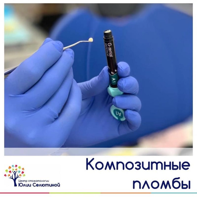 Композитные пломбировочные материалы.