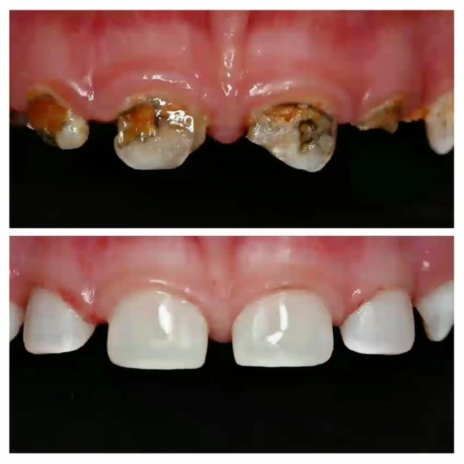 Клинический случай: лечение малыша под наркозом.