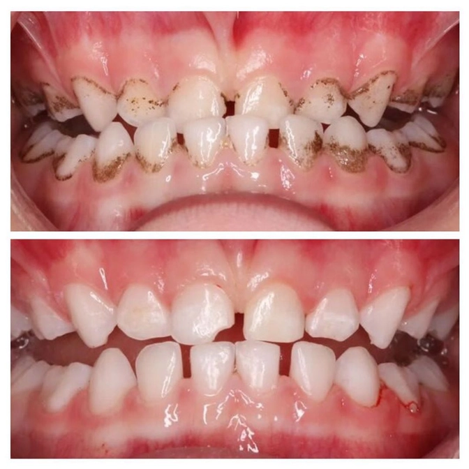 Налет Пристли.