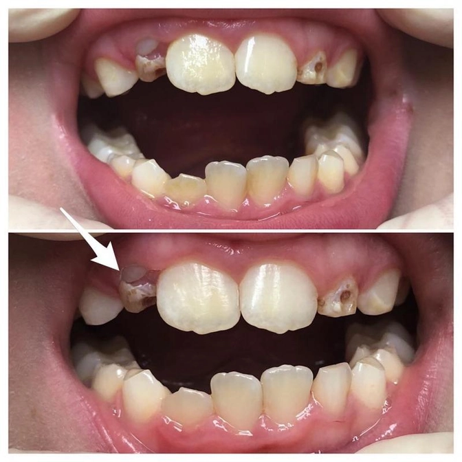 Клинический случай: гигиена.