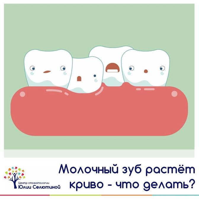 Молочный зуб прорезался криво: почему и что делать?