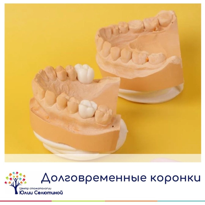 Как изготавливаются коронки. 