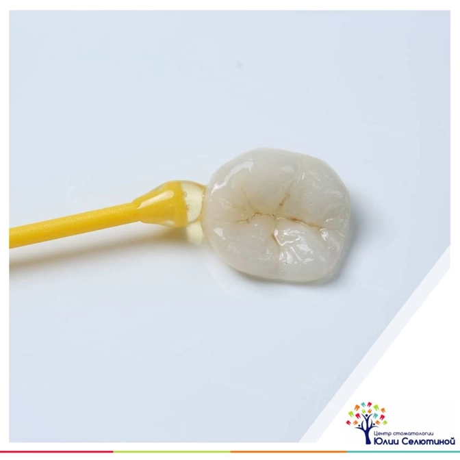 Нужно ли менять керамические вкладки?