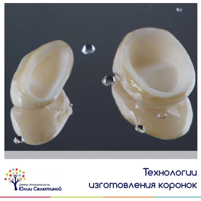Технология изготовления коронок 